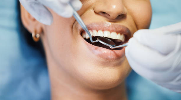 Best Emergency Gum Treatment in Concordia, KS
