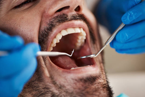 Best Same-Day Emergency Dental Services in Concordia, KS